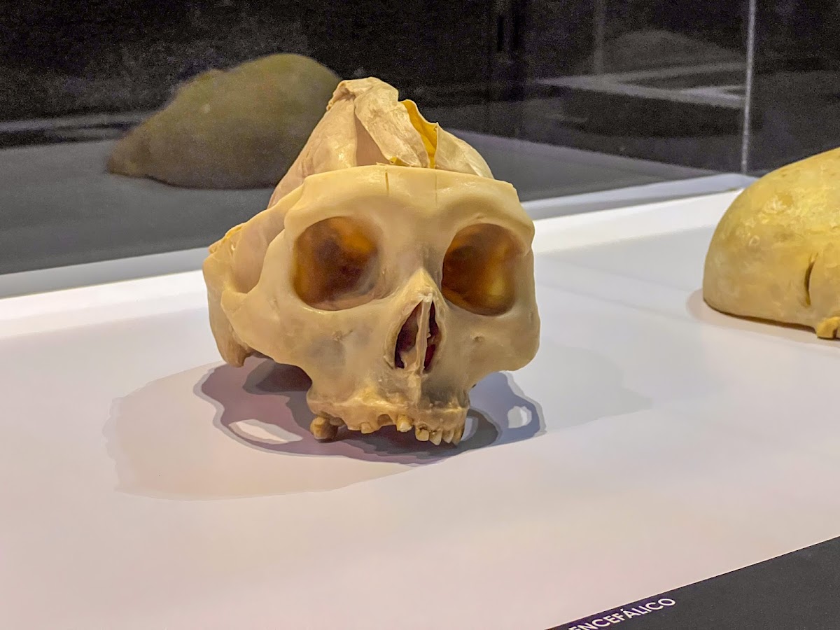 Sorpréndete con Our Body: El universo dentro — ''Our Body: El universo dentro'' Ciudad de México